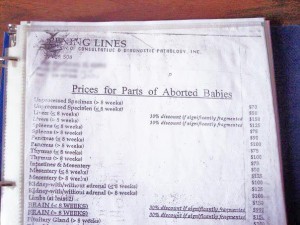 aborted-babies-parts-price-list