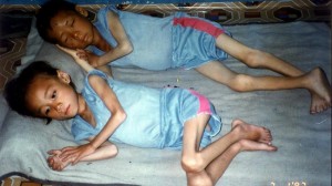 404410-north-korea-famine