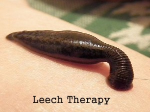 GlebK512px-Sucking_leech1